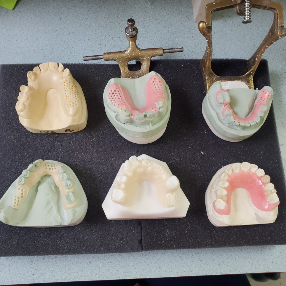 3D Printed Partial Denture