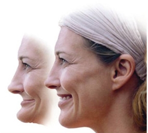 Appearance before and after dentures 