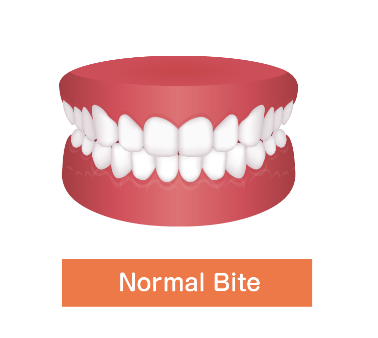 Normal Bite
